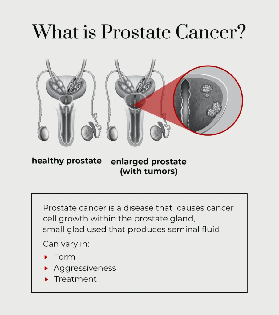 VA Disability for Prostate Cancer